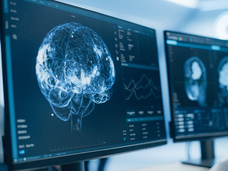 Two monitors display a brain visualization and several scan slices.