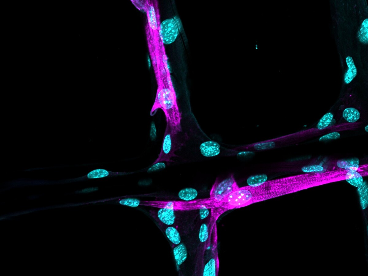 Fluorescent microscopy reveals cells around branching tissue.